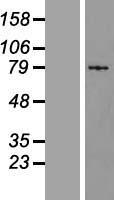 S100G / CABP9K Protein - Western validation with an anti-DDK antibody * L: Control HEK293 lysate R: Over-expression lysate