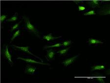S100P Antibody - Immunofluorescence of monoclonal antibody to S100P on HeLa cell . [antibody concentration 10 ug/ml]