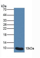 S100P Antibody - Western Blot; Sample: Human Leukocyte Cells.