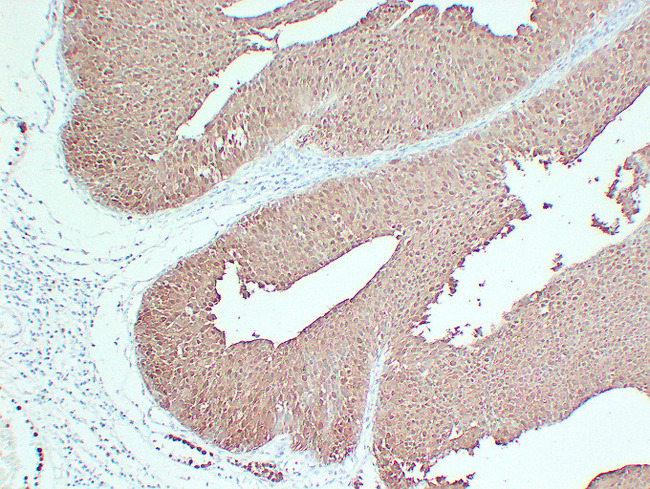 S100P Antibody - Transitional Cell Carcinoma