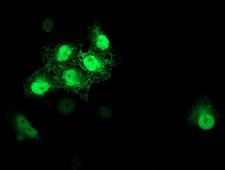 S100P Antibody - Anti-S100P mouse monoclonal antibody immunofluorescent staining of COS7 cells transiently transfected by pCMV6-ENTRY S100P.