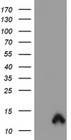 S100P Antibody - HEK293T cells were transfected with the pCMV6-ENTRY control (Left lane) or pCMV6-ENTRY S100P (Right lane) cDNA for 48 hrs and lysed. Equivalent amounts of cell lysates (5 ug per lane) were separated by SDS-PAGE and immunoblotted with anti-S100P.