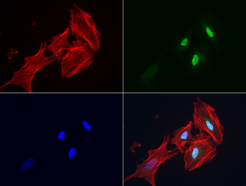 S100P Antibody - Immunofluorescent staining of HeLa cells using anti-S100P mouse monoclonal antibody  green, 1:50). Actin filaments were labeled with Alexa Fluor® 594 Phalloidin. (red), and nuclear with DAPI. (blue).