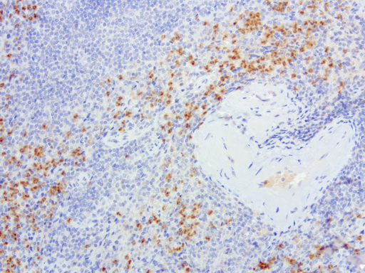 S100P Antibody - Immunohistochemical staining of paraffin-embedded human spleen using anti-S100P clone UMAB24 mouse monoclonal antibody  at 1:200 with Polink2 Broad HRP DAB detection kit; heat-induced epitope retrieval with GBI Accel pH8.7 HIER buffer using pressure chamber for 3 minutes at 110C. Nuclear and cytoplasmic staining is seen in red pulp cells.
