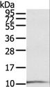 S100P Antibody - Western blot analysis of A431 cell, using S100P Polyclonal Antibody at dilution of 1:600.