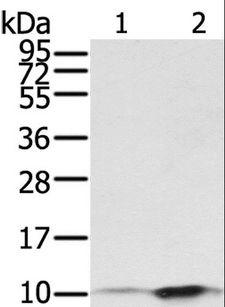 S100P Antibody - Western blot analysis of A431 and HeLa cell, using S100P Polyclonal Antibody at dilution of 1:650.