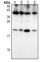 S100P Antibody - Western blot analysis of S100-P expression in MEF (A), C6 (B), A549 (C), H1792 (D) whole cell lysates.