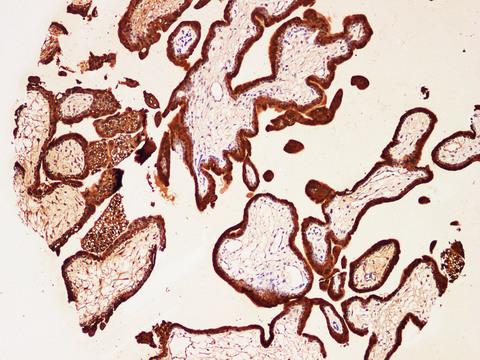 S100P Antibody - Immunohistochemistry of paraffin-embedded Human placenta using S100P Polyclonal Antibody at dilution of 1:200(100×).