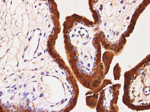 S100P Antibody - Immunohistochemistry of paraffin-embedded Human placenta using S100P Polyclonal Antibody at dilution of 1:200(400×).