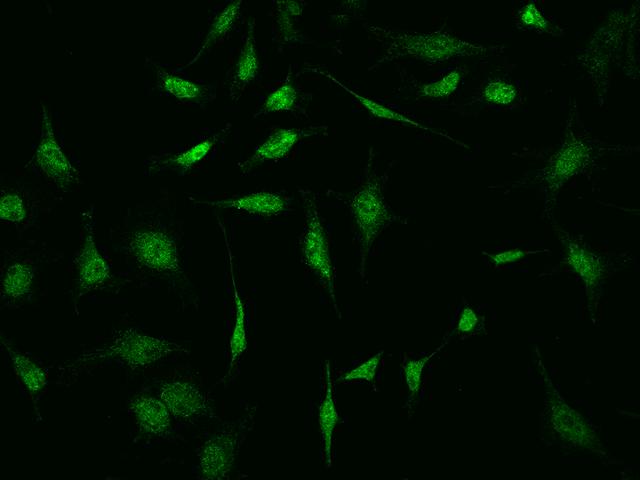 S100P Antibody - Immunofluorescence staining of S100P in HeLa cells. Cells were fixed with 4% PFA, permeabilzed with 0.1% Triton X-100 in PBS, blocked with 10% serum, and incubated with rabbit anti-human S100P polyclonal antibody (dilution ratio 1:1000) at 4°C overnight. Then cells were stained with the Alexa Fluor 488-conjugated Goat Anti-rabbit IgG secondary antibody (green). Positive staining was localized to Nucleus.