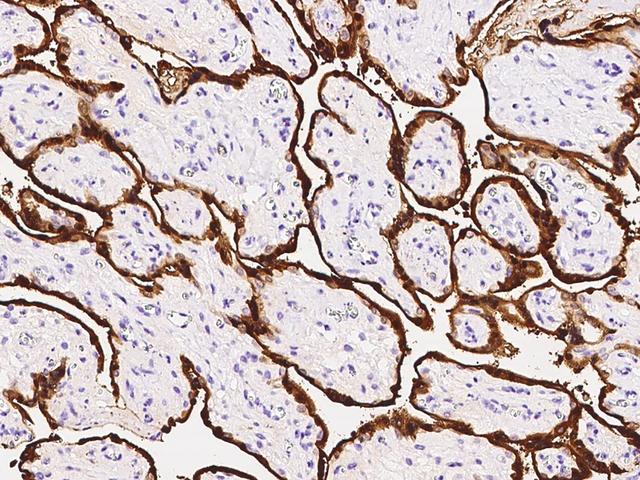 S100P Antibody - Immunochemical staining of human S100P in human placenta with rabbit polyclonal antibody at 1:1000 dilution, formalin-fixed paraffin embedded sections.