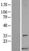 S100P Protein - Western validation with an anti-DDK antibody * L: Control HEK293 lysate R: Over-expression lysate
