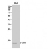 S100Z Antibody - Western blot of S-100Z antibody