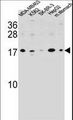 S100Z Antibody - S100Z Antibody western blot of MDA-MB453,K562,SK-BR-3,HepG2 cell line and mouse stomach tissue lysates (35 ug/lane). The S100Z antibody detected the S100Z protein (arrow).