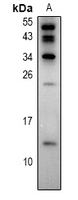 S100Z Antibody - Western blot analysis of S100-Z expression in K562 (A) whole cell lysates.