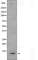 S100Z Antibody - Western blot analysis of extracts of COLO cells using S100Z antibody.