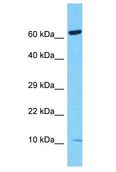 S100Z Antibody - S100Z antibody Western Blot of HeLa. Antibody dilution: 1 ug/ml.  This image was taken for the unconjugated form of this product. Other forms have not been tested.