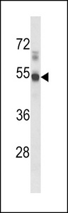 S1PR1 / EDG1 / S1P1 Antibody - Western blot of hEDG1-I25 in mouse lung tissue lysates (35 ug/lane). EDG1 (arrow) was detected using the purified antibody.