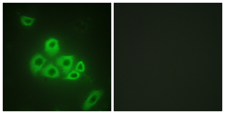 S1PR1 / EDG1 / S1P1 Antibody - Immunofluorescence analysis of A549 cells, using S1P Receptor EDG1 Antibody. The picture on the right is blocked with the synthesized peptide.
