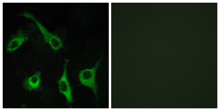 S1PR1 / EDG1 / S1P1 Antibody - Immunofluorescence analysis of COS7 cells, using EDG1 Antibody. The picture on the right is blocked with the synthesized peptide.