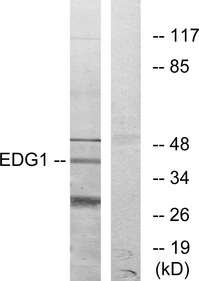S1PR1 / EDG1 / S1P1 Antibody - Western blot analysis of lysates from COLO205 cells, using EDG1 Antibody. The lane on the right is blocked with the synthesized peptide.
