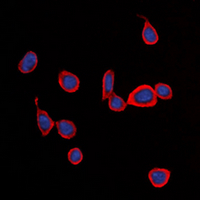 S1PR1 / EDG1 / S1P1 Antibody - Immunofluorescent analysis of CD363 staining in Jurkat cells. Formalin-fixed cells were permeabilized with 0.1% Triton X-100 in TBS for 5-10 minutes and blocked with 3% BSA-PBS for 30 minutes at room temperature. Cells were probed with the primary antibody in 3% BSA-PBS and incubated overnight at 4 deg C in a humidified chamber. Cells were washed with PBST and incubated with a DyLight 594-conjugated secondary antibody (red) in PBS at room temperature in the dark. DAPI was used to stain the cell nuclei (blue).