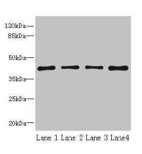 S1PR1 / EDG1 / S1P1 Antibody - Western blot All lanes: S1PR1 antibody at 2µg/ml Lane 1: Jurkat cells Lane 2: A375 cellS Lane 3: Mouse pancreatic tissue Lane 4: HepG2 cells Secondary Goat polyclonal to rabbit IgG at 1/10000 dilution Predicted band size: 43 kDa Observed band size: 43 kDa