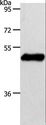 S1PR1 / EDG1 / S1P1 Antibody - Western blot analysis of Mouse brain tissue, using S1PR1 Polyclonal Antibody at dilution of 1:750.