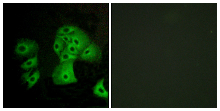 S1PR4 / SIP4 / EDG6 Antibody - Immunofluorescence analysis of A549 cells, using EDG6 Antibody. The picture on the right is blocked with the synthesized peptide.