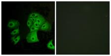 S1PR4 / SIP4 / EDG6 Antibody - Immunofluorescence analysis of A549 cells, using EDG6 Antibody. The picture on the right is blocked with the synthesized peptide.