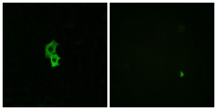 S1PR4 / SIP4 / EDG6 Antibody - Immunofluorescence analysis of HepG2 cells, using EDG6 Antibody. The picture on the right is blocked with the synthesized peptide.