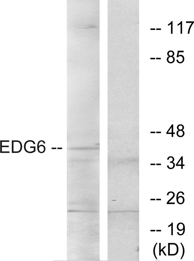 S1PR4 / SIP4 / EDG6 Antibody - Western blot analysis of lysates from K562 cells, using EDG6 Antibody. The lane on the right is blocked with the synthesized peptide.