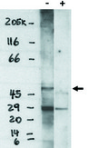 S1PR4 / SIP4 / EDG6 Antibody - Western blot of EDG6 (S1P4) antibody on RH7777 cells transfected with EDG6 (S1P4) protein in the presence (1) and absence (+) of specific blocking peptide.