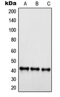 S1PR4 / SIP4 / EDG6 Antibody - Western blot analysis of EDG6 expression in Jurkat (A); HepG2 (B); HEK293 (C) whole cell lysates.
