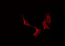 S1PR4 / SIP4 / EDG6 Antibody - Staining HeLa cells by IF/ICC. The samples were fixed with PFA and permeabilized in 0.1% Triton X-100, then blocked in 10% serum for 45 min at 25°C. The primary antibody was diluted at 1:200 and incubated with the sample for 1 hour at 37°C. An Alexa Fluor 594 conjugated goat anti-rabbit IgG (H+L) Ab, diluted at 1/600, was used as the secondary antibody.