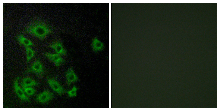 S1PR5 / EDG8 / S1P5 Antibody - Immunofluorescence analysis of A549 cells, using EDG8 Antibody. The picture on the right is blocked with the synthesized peptide.