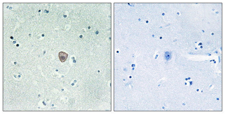 S1PR5 / EDG8 / S1P5 Antibody - Immunohistochemistry analysis of paraffin-embedded human brain tissue, using EDG8 Antibody. The picture on the right is blocked with the synthesized peptide.