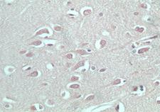 S1PR5 / EDG8 / S1P5 Antibody - IHC (paraffin) staining of normal human brain using antibody (Edg8) at 5 ug/ml.