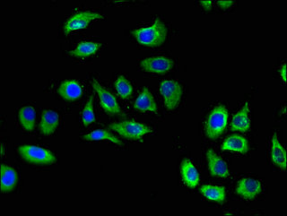 S1PR5 / EDG8 / S1P5 Antibody - Immunofluorescent analysis of A549 cells using S1PR5 Antibody at a dilution of 1:100 and Alexa Fluor 488-congugated AffiniPure Goat Anti-Rabbit IgG(H+L)