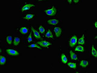 S1PR5 / EDG8 / S1P5 Antibody - Immunofluorescent analysis of A549 cells using S1PR5 Antibody at dilution of 1:100 and Alexa Fluor 488-congugated AffiniPure Goat Anti-Rabbit IgG(H+L)