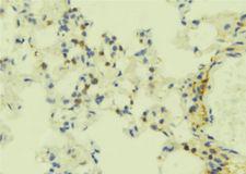 S1PR5 / EDG8 / S1P5 Antibody - 1:100 staining mouse lung tissue by IHC-P. The sample was formaldehyde fixed and a heat mediated antigen retrieval step in citrate buffer was performed. The sample was then blocked and incubated with the antibody for 1.5 hours at 22°C. An HRP conjugated goat anti-rabbit antibody was used as the secondary.