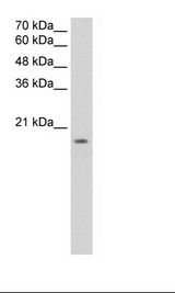 S1PR5 / EDG8 / S1P5 Antibody - Jurkat Cell Lysate.  This image was taken for the unconjugated form of this product. Other forms have not been tested.