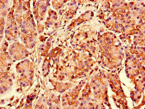 S26 / RPS26 Antibody - Immunohistochemistry of paraffin-embedded human pancreatic tissue using RPS26 Antibody at dilution of 1:100