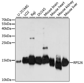 S26 / RPS26 Antibody - Western blot analysis of extracts of various cell lines, using RPS26 antibody at 1:1000 dilution. The secondary antibody used was an HRP Goat Anti-Rabbit IgG (H+L) at 1:10000 dilution. Lysates were loaded 25ug per lane and 3% nonfat dry milk in TBST was used for blocking. An ECL Kit was used for detection and the exposure time was 30s.