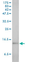 SAA1 / SAA / Serum Amyloid A Antibody - SAA1 monoclonal antibody (M01), clone 3C11-2C1. Western blot of SAA1 expression in human spleen.