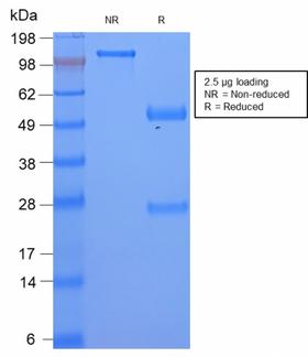 SAA1 / SAA / Serum Amyloid A Antibody - SDS-PAGE Analysis Serum Amyloid A Rabbit Recombinant Monoclonal Antibody (SAA/2868R). Confirmation of Purity and Integrity of Antibody