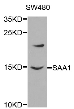SAA1 / SAA / Serum Amyloid A Antibody - Western blot analysis of extracts of SW480 cells, using SAA1 antibody at 1:1000 dilution. The secondary antibody used was an HRP Goat Anti-Rabbit IgG (H+L) at 1:10000 dilution. Lysates were loaded 25ug per lane and 3% nonfat dry milk in TBST was used for blocking.
