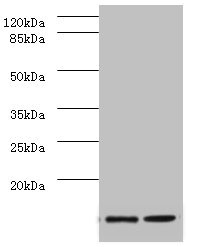 SAA1 / SAA / Serum Amyloid A Antibody - All  Lanes: Serum amyloid A-1 antibody at 2ug/ml Lane 1: human high values of serum CRP50 Lane 2: human high values of serum CRP100 Secondary Goat polyclonal to rabbit at 1/10000 dilution Predicted band size: 13kDa Observed band size: 13kDa