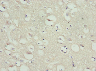 SAA1 / SAA / Serum Amyloid A Antibody - Immunohistochemistry of paraffin-embedded human brain tissue at dilution 1:100