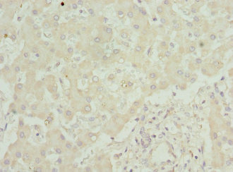 SAA1 / SAA / Serum Amyloid A Antibody - Immunohistochemistry of paraffin-embedded human liver tissue at dilution 1:100